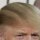 How Does Donald Trump Comb His Hair?